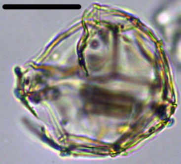 Impagidinium dispertitum Idisp30X1101103120990b.jpg